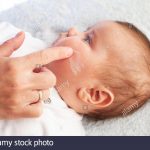 Crema Dermatitis Bebé Cara