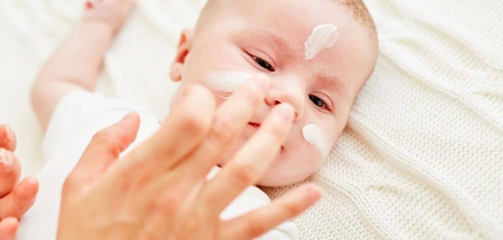 crema facial bebe dermatitis