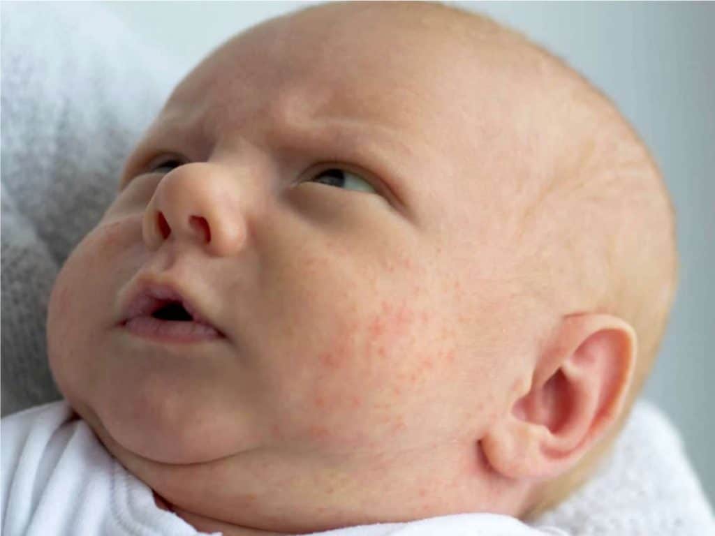 crema facial bebe granitos