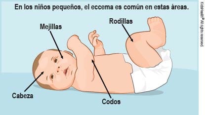 crema para mejillas rojas bebe